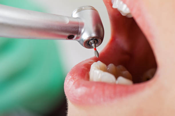 Best Weekend Emergency Dentist in Apex, NC